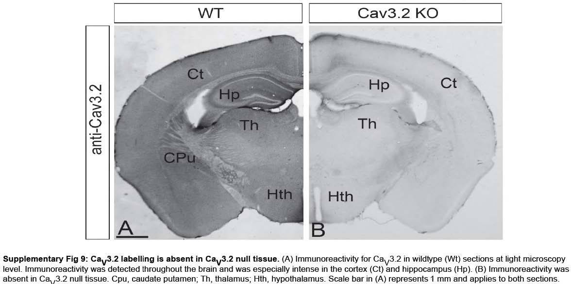 Anti-Cav3.2 Ca2+ Channel Antibody - Image 2