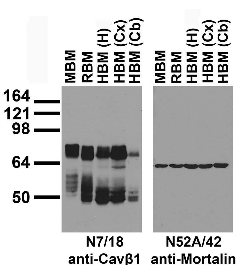 Anti-Cavbeta1 Ca2+ Channel Antibody - Image 3