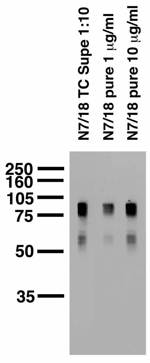 Anti-Cavbeta1 Ca2+ Channel Antibody - Image 4