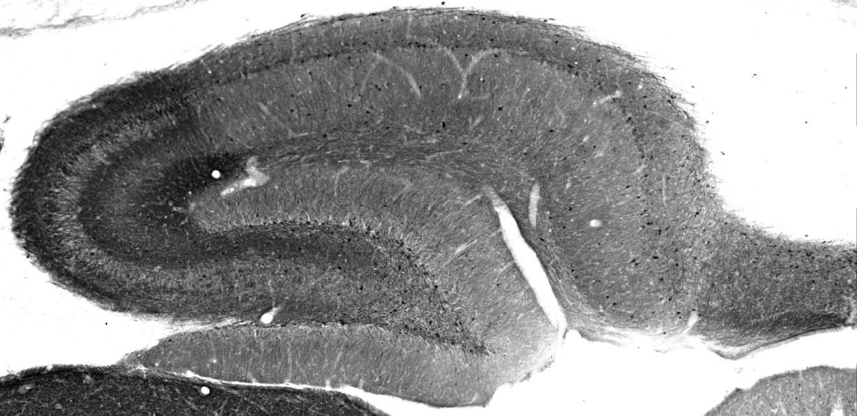 Anti-Cavbeta2 Ca2+ Channel Antibody - Image 2