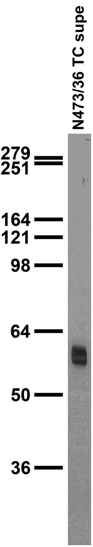Anti-Cavß3 Calcium Channel Antibody - Image 2