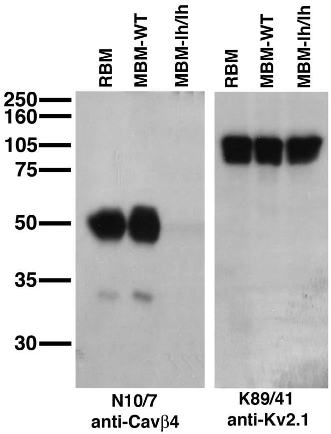 Anti-Cavbeta4 Ca2+ Channel Antibody