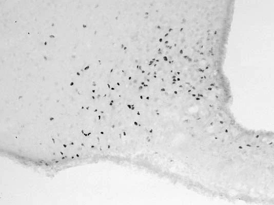 Anti-Cellular oncogene fos (c-Fos) Antibody