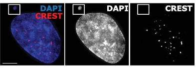 Anti-Centromere Protein Antibody - Image 10