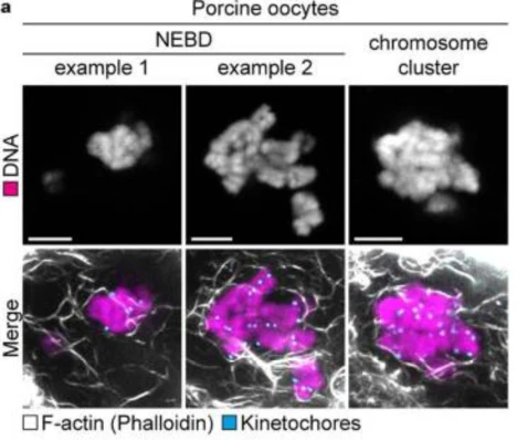 Anti-Centromere Protein Antibody - Image 11