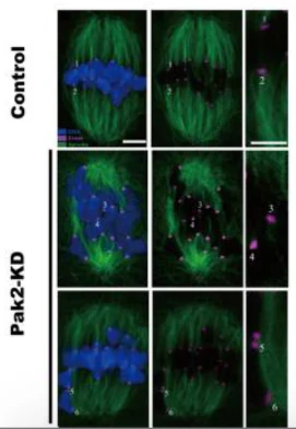 Anti-Centromere Protein Antibody - Image 12