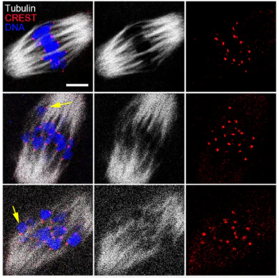 Anti-Centromere Protein Antibody - Image 13