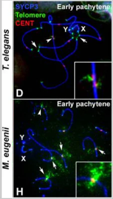 Anti-Centromere Protein Antibody - Image 14