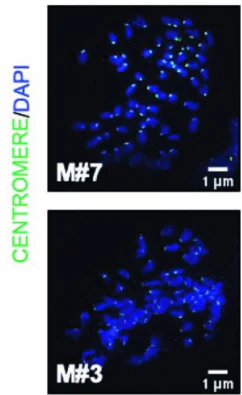 Anti-Centromere Protein Antibody - Image 15