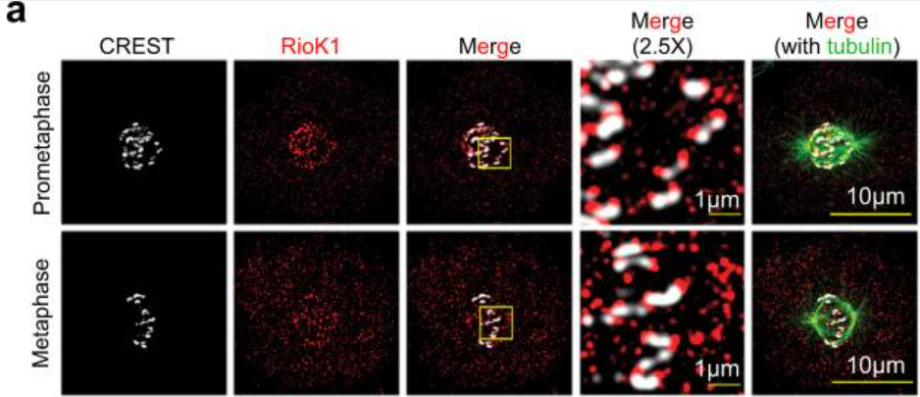 Anti-Centromere Protein Antibody - Image 16