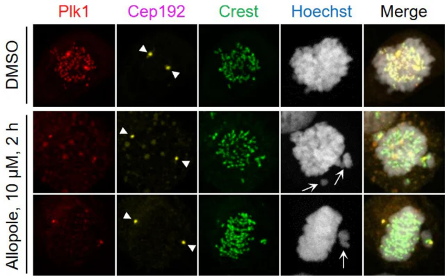 Anti-Centromere Protein Antibody - Image 17