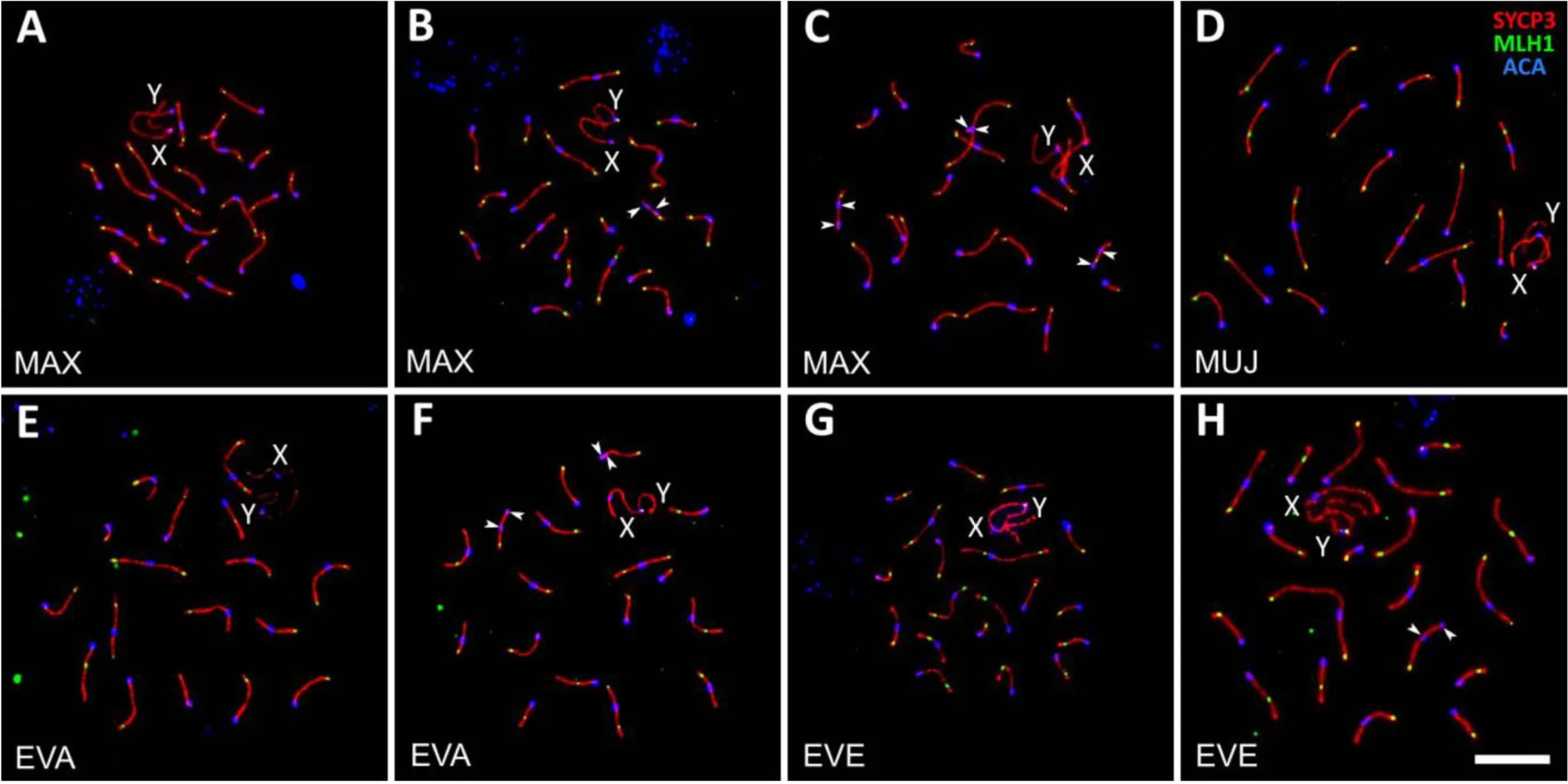 Anti-Centromere Protein Antibody - Image 18