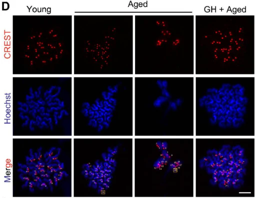 Anti-Centromere Protein Antibody - Image 19