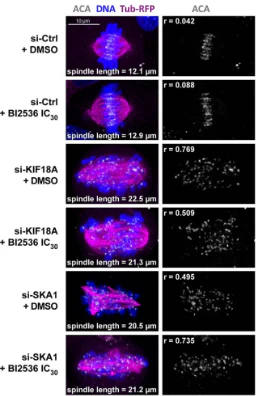 Anti-Centromere Protein Antibody - Image 20