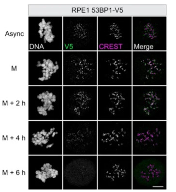 Anti-Centromere Protein Antibody - Image 21