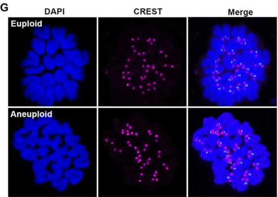Anti-Centromere Protein Antibody - Image 22