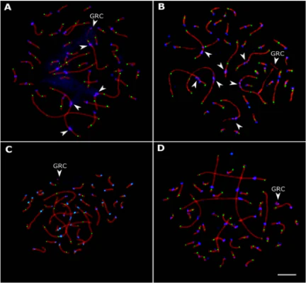 Anti-Centromere Protein Antibody - Image 23