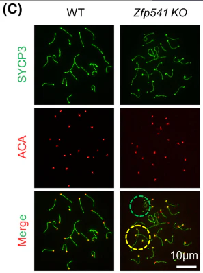 Anti-Centromere Protein Antibody - Image 24