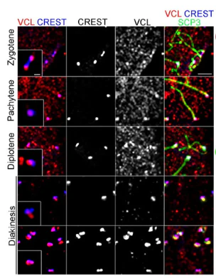Anti-Centromere Protein Antibody - Image 3