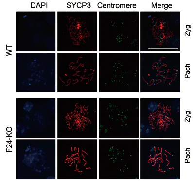 Anti-Centromere Protein Antibody - Image 5