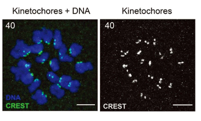 Anti-Centromere Protein Antibody - Image 6