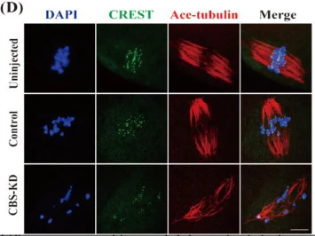 Anti-Centromere Protein Antibody - Image 8