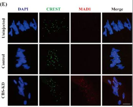 Anti-Centromere Protein Antibody - Image 9
