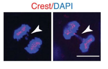 Anti-Centromere Protein Antibody - Image 3