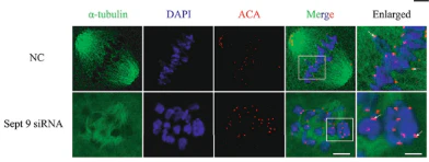 Anti-Centromere Protein Antibody - Image 4