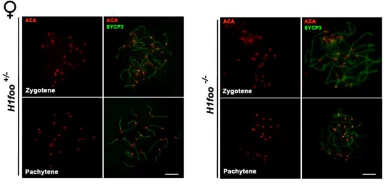 Anti-Centromere Protein Antibody - Image 5