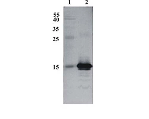 Anti-Cerebral dopamine neurotrophic factor (CDNF) Antibody