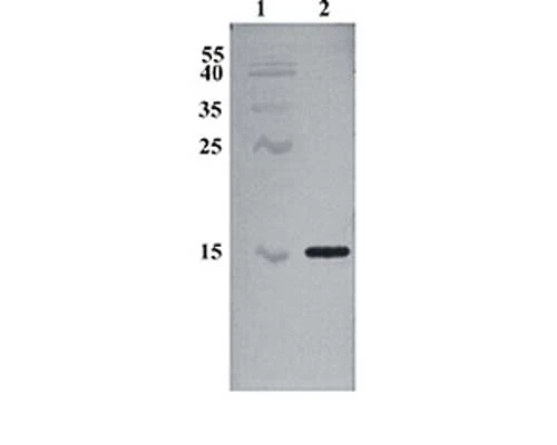 Anti-Cerebral dopamine neurotrophic factor (CDNF) Antibody