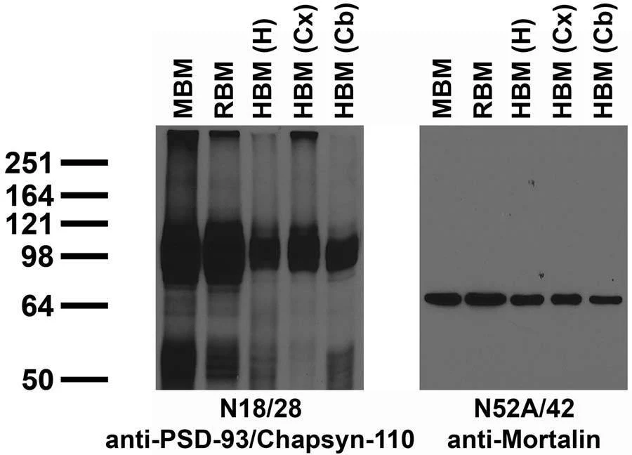 Anti-Chapsyn-110 MAGUK Antibody