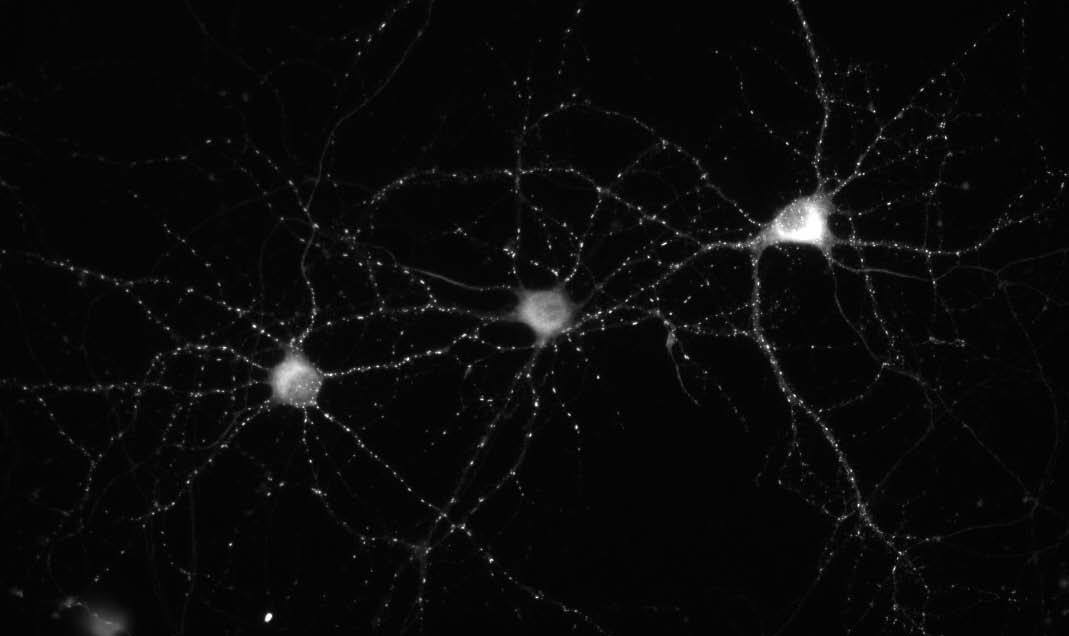 Anti-Chapsyn-110 MAGUK Antibody - Image 2