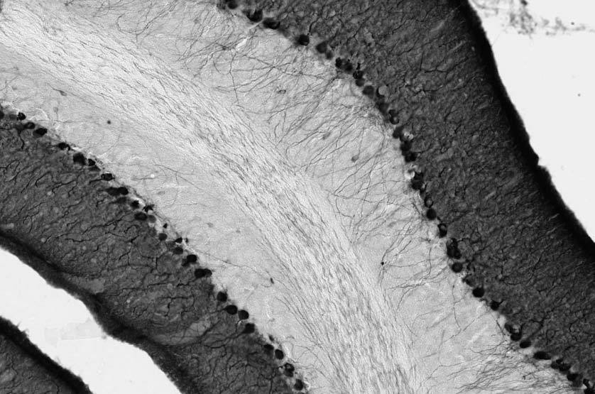 Anti-Chapsyn-110 MAGUK Antibody - Image 3
