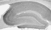 Anti-Chapsyn-110 MAGUK Antibody - Image 4