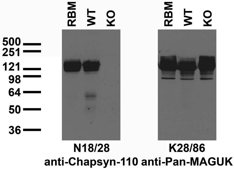 Anti-Chapsyn-110 MAGUK Antibody - Image 5