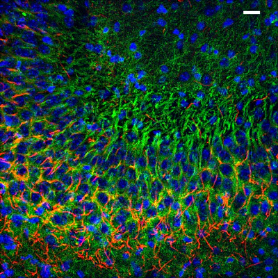Anti-Chapsyn-110/PSD-93 Antibody