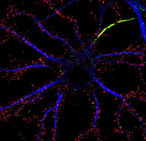 Anti-Chapsyn-110/PSD-93 Antibody - Image 3