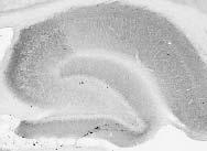 Anti-Chapsyn-110/PSD-93 Antibody - Image 4