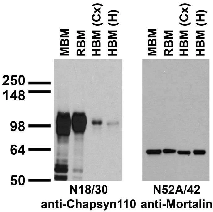 Anti-Chapsyn-110/PSD-93 Antibody - Image 6