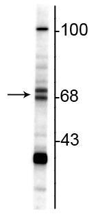 Anti-ChAT (Choline Acetyltransferase) Antibody