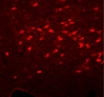 Anti-Choline O-acetyltransferase (ChAT) Antibody