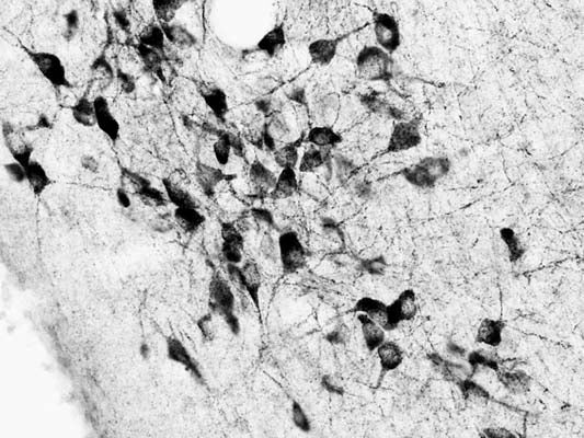 Anti-Choline O-acetyltransferase (ChAT) Antibody - Image 2