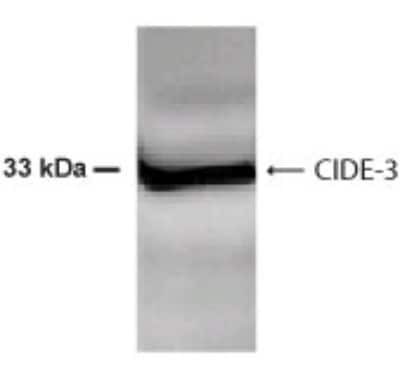 Anti-CIDE3 Antibody
