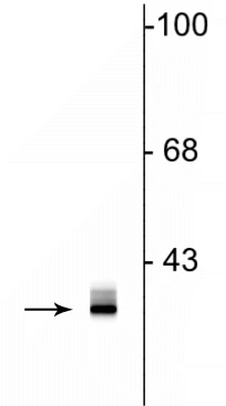 Anti-Clavesin Antibody