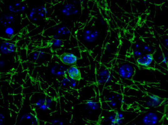 Anti-CNP (2,3-cyclic nucleotide-3-phosphodiesterase) Antibody