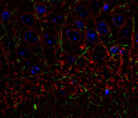 Anti-CNP (2,3-cyclic nucleotide-3-phosphodiesterase) Antibody - Image 3