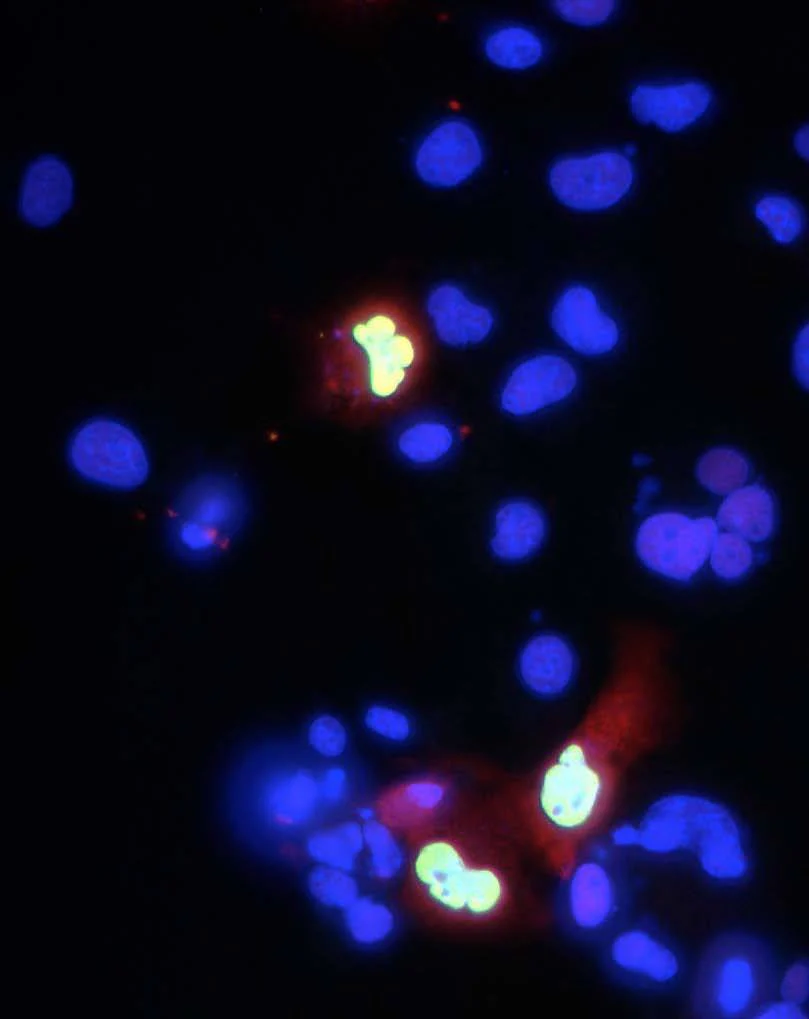 Anti-Co-Rest/RCOR1 Antibody
