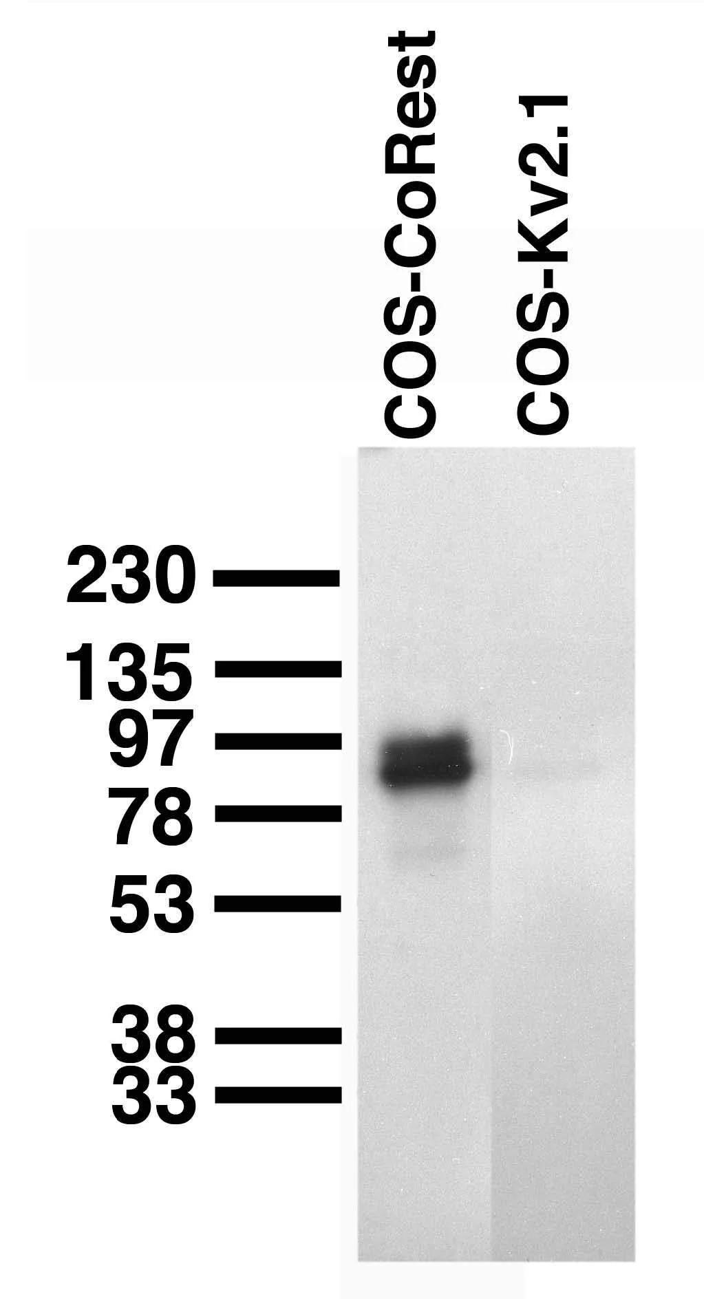 Anti-Co-Rest/RCOR1 Antibody - Image 2